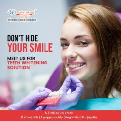 Hyderabad Smiles Achieve Your Brightest Teeth Whitening Yet