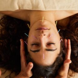 Acupuncture-Face-Wellness