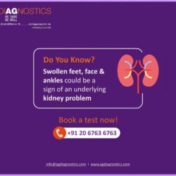 Kidney-Function-Tests-in-Pune-AG-Diagnostics