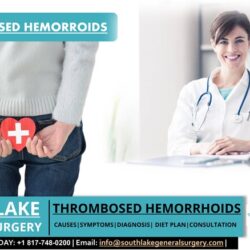 Thrombosed Hemorrhoids -Southlake General Surgery