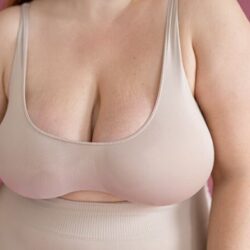 Common-Problems-after-Breast-Reduction-Surgery-Dr-Rajat-Gupta-RG-Aesthetics-01