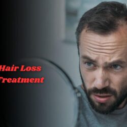 Hair Loss Treatment Charma Clinic