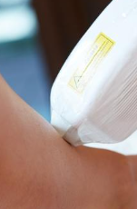 Laser hair removal classified
