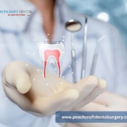 Root Canal Treatment in Abingdon