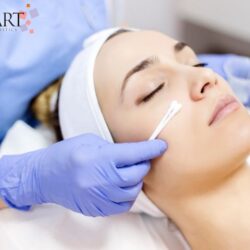 Chemical Peel Treatment in Lucknow