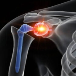 orthopedics-joint-replacement-banner