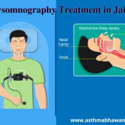 Polysomnography-Treatment-in-Jaipur (1)