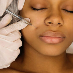 restylane-injectables-and-fillers