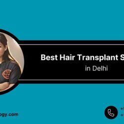 Best Hair Transplant Surgeon in Delhi(2)