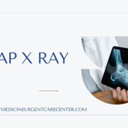 Cheap X ray