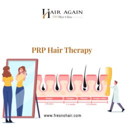 PRP Hair Therapy_1