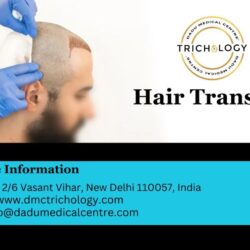 Hair Transplant in India (2)