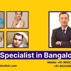 Skin Specialist in Bangalore