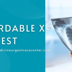 Affordable X-ray test
