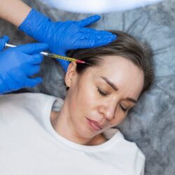 top-view-woman-getting-prp-treatment_23-2149341416