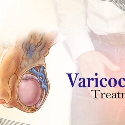 varicocele treatment in Bangalore