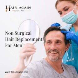non surgical hair restoration-1_1