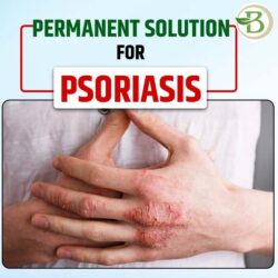 permanent solution for psoriasis